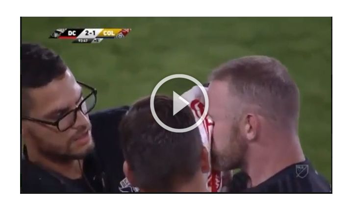 AUUUĆ! Rooney zalany krwią po starciu z rywalem! [VIDEO]